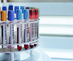 Vials for Gleevec Pharmacogenomic Test